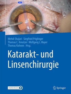 Shajari_katarakt_linsenchirurgie