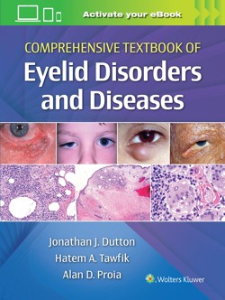 dutton_tb_eyelid_disorders
