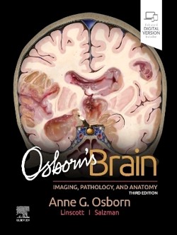 osborn_osborns_brain_3a