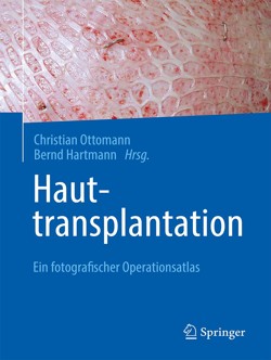 ottomann_hauttransplantation