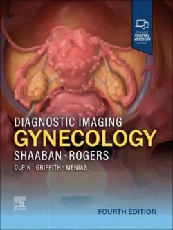 shaaban_di_gynecology_4a