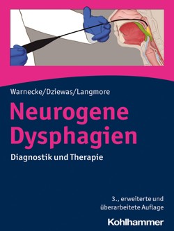 warnecke_neurogene_dysphagien_3a